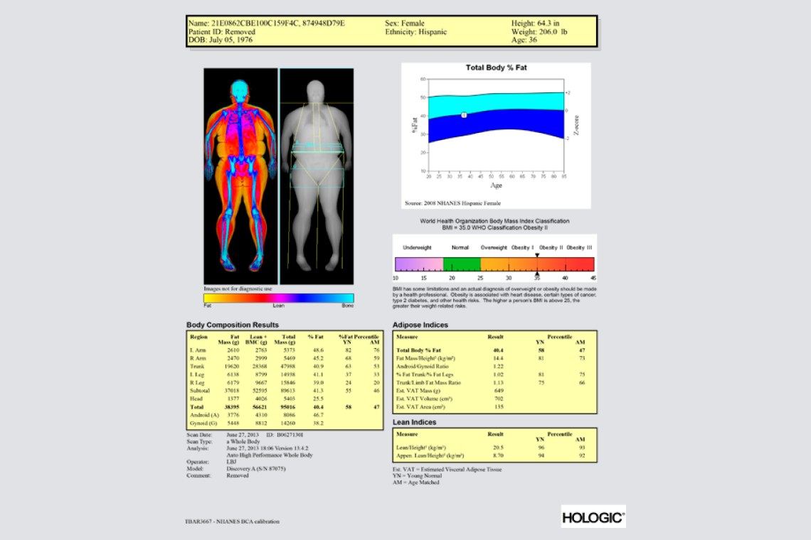 Sample DEXA scan report from Moonshot Medical, delivered through Moonshot Clinic